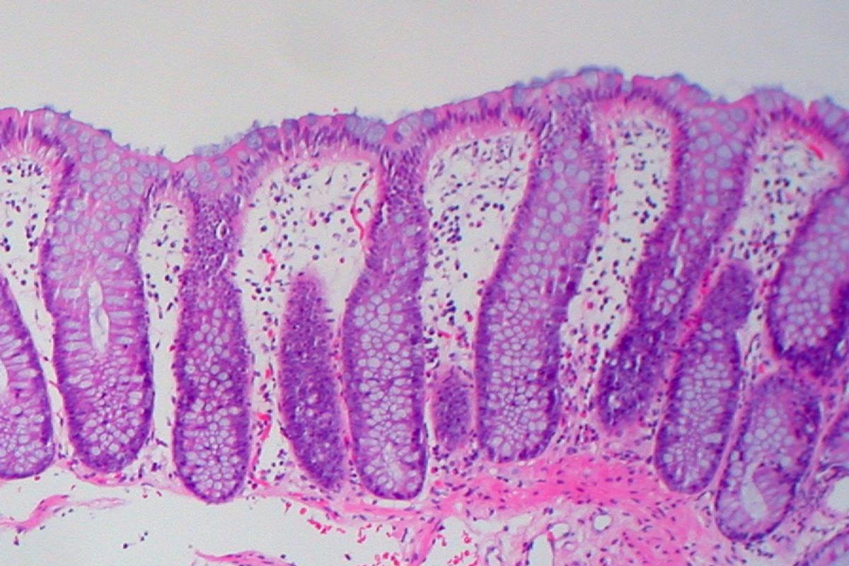 Mucosa de colon normal.